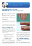 Psoriasis también en las uñas