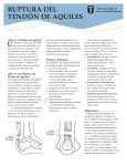 ruptura del tendón de aquiles
