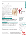 Histerectomía - BlueAppleCare