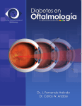 Diabetes en Oftalmología