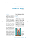 Artroplastias de la rodilla