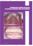 Rehabilitación completa del maxilar con prótesis cementada sobre