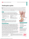 Achilles Tendinopathy