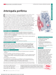 Peripheral Arterial Disease