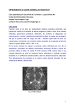 Empeoramiento de lesión cerebral en paciente VIH