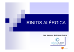 rinitis alérgica