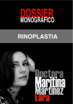 rinoplastia - Doctora Martinez Lara