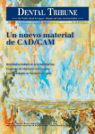 Un nuevo material de CAD/CAM - Asociación Odontologica Uruguaya