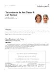Tratamiento de las clases II con forsus. Revista española de