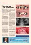 Implantología Oral - Dental Tribune International