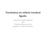Trombolisis en Infarto Cerebral Agudo.