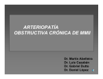 arteriopatía obstructiva crónica de mmii